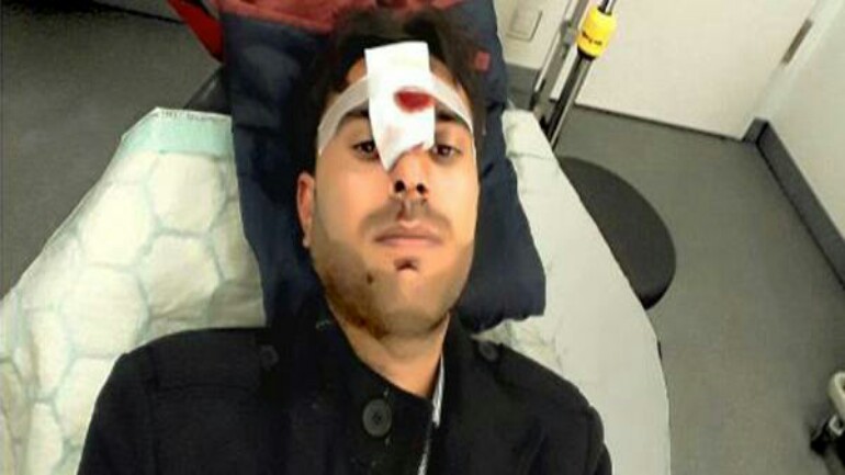 امرأة ألمانية تضرب لاجيء على رأسه بزجاجة البيرة