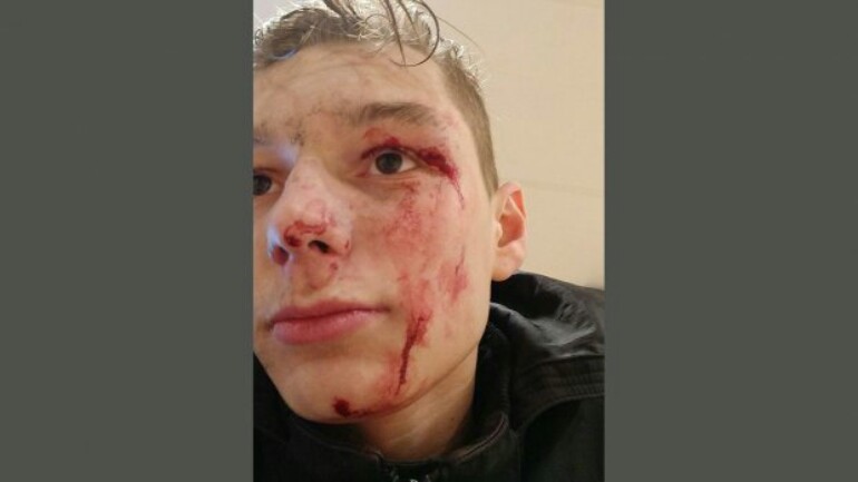 كوين يبحث عن شابان أسعفاه للمشفى ليشكرهما - أحدهما اسمه طارق