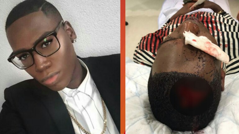 من جديد: الاعتداء بالضرب على شاب مثلي الجنس وسرقته في أمستردام