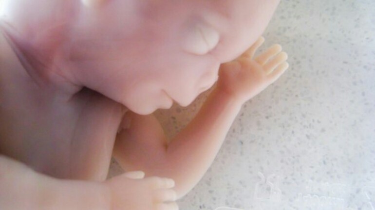 مشفى AMC أمستردام سيحتفظ بالأجنة المتوفاة لأجل البحوث العلمية