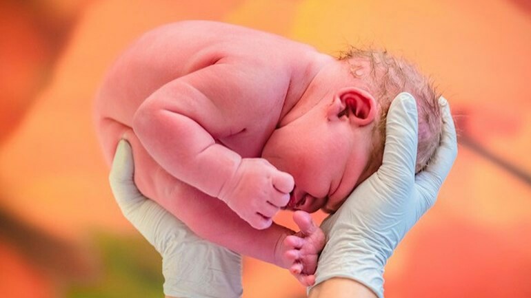 قصة صورة لمولود في Zaandam و التي لفتت انتباه وسائل الاعلام العالمية