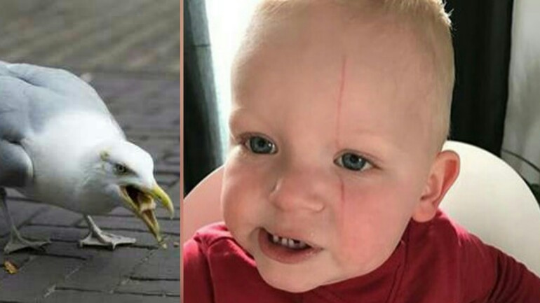 نورس يهاجم طفلا (عام واحد) ويجرحه في وجهه في بيفرفايك