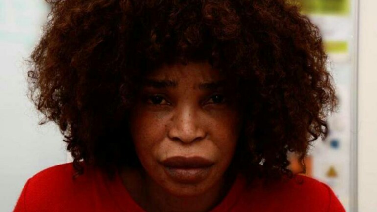 السجن مدى الحياة لامرأة سكبت الأسيد الحارق على حبيبها الهولندي لكي لا يذهب لامرأة أخرى