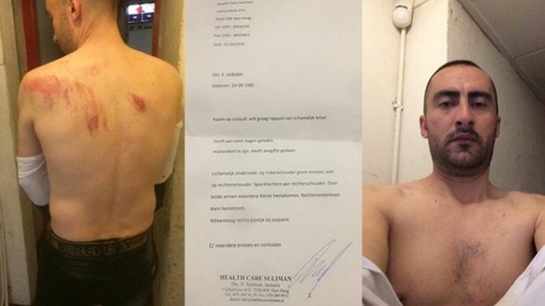 تعرض الرجل الكردي للضرب بعصا في القنصلية التركية بروتردام
