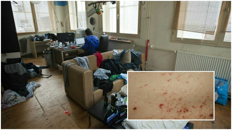 عدد كبير من مساكن طلاب الجامعات في هولندا تعاني من الإصابة بمرض الجرب