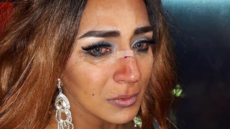 الإعتداء على امرأة في الشارع بأمستردام - الشرطة تبحث عن شهود