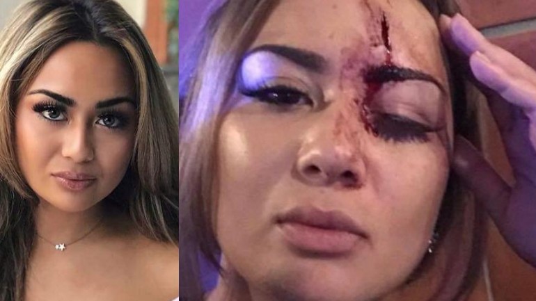 حاولت الدفاع عن شاب مذعور يطارده 30 شخص فتلقت هي الضربات في أمستردام