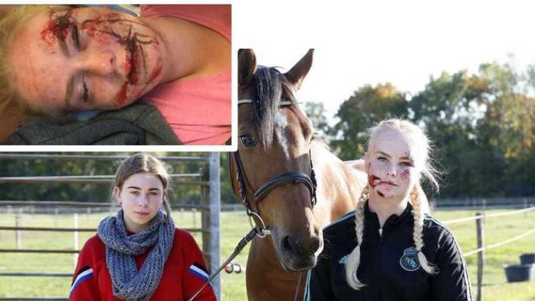 شايان "16 عام" تعرضت لكسور في وجهها وزراعها بسبب "المهرج القاتل" في أوتريخت