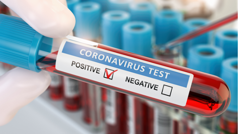 المعهد الصحي يعلن عن إصابة 655 شخص جديد و وفاة 120 مريض بفيروس كورونا: أصبح العدد 37,190 مصاباً في هولندا