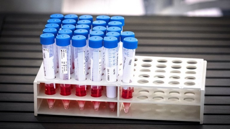 شركة هولندية باعت مليون ونصف اختبار غير موثوق لفيروس كورونا